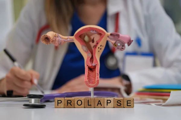 Prolapse